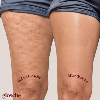 Glosche Lifting Tape — Legs, Tummy & Arms