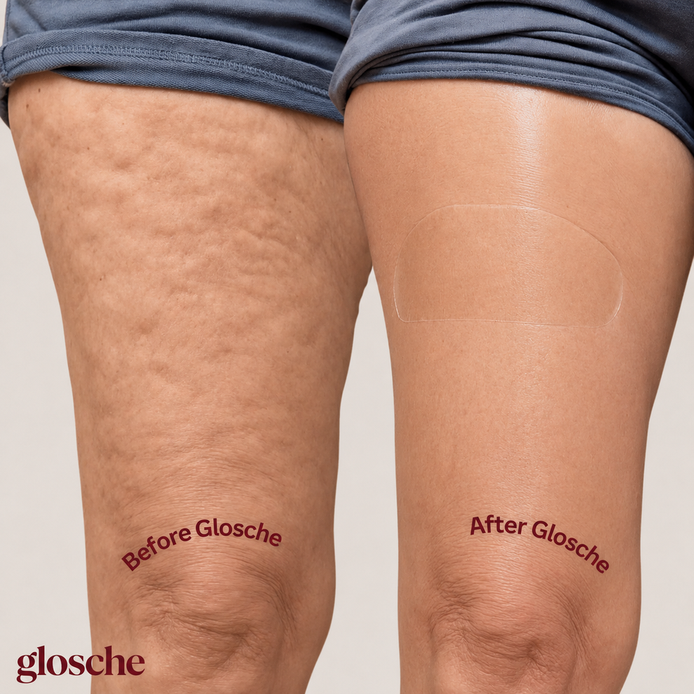 Glosche lifting tape tummy application